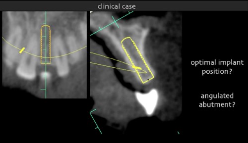 Using diagnostic information